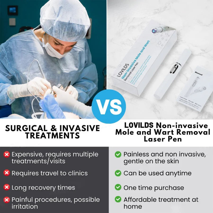đĽăOFFICIAL STOREă Non-Invasive Mole and Wart Removal Laser Pen