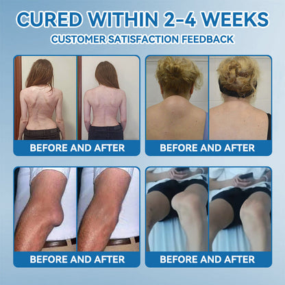 BPC-157 Joint Healing Cream🦴Treats Arthritis, Neuropathy, Rheumatism, Sports Injuries & More-USA👍