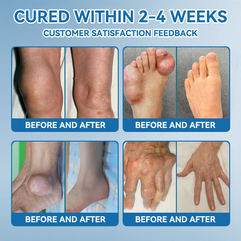 BPC-157 Joint Healing Cream🦴Treats Arthritis, Neuropathy, Rheumatism, Sports Injuries & More-USA👍