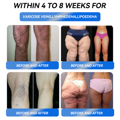 ✅Enjoy 30% OFF for adding the second one