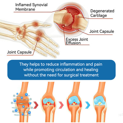 BPC-157 Joint Healing Cream🦴Treats Arthritis, Neuropathy, Rheumatism, Sports Injuries & More-USA👍