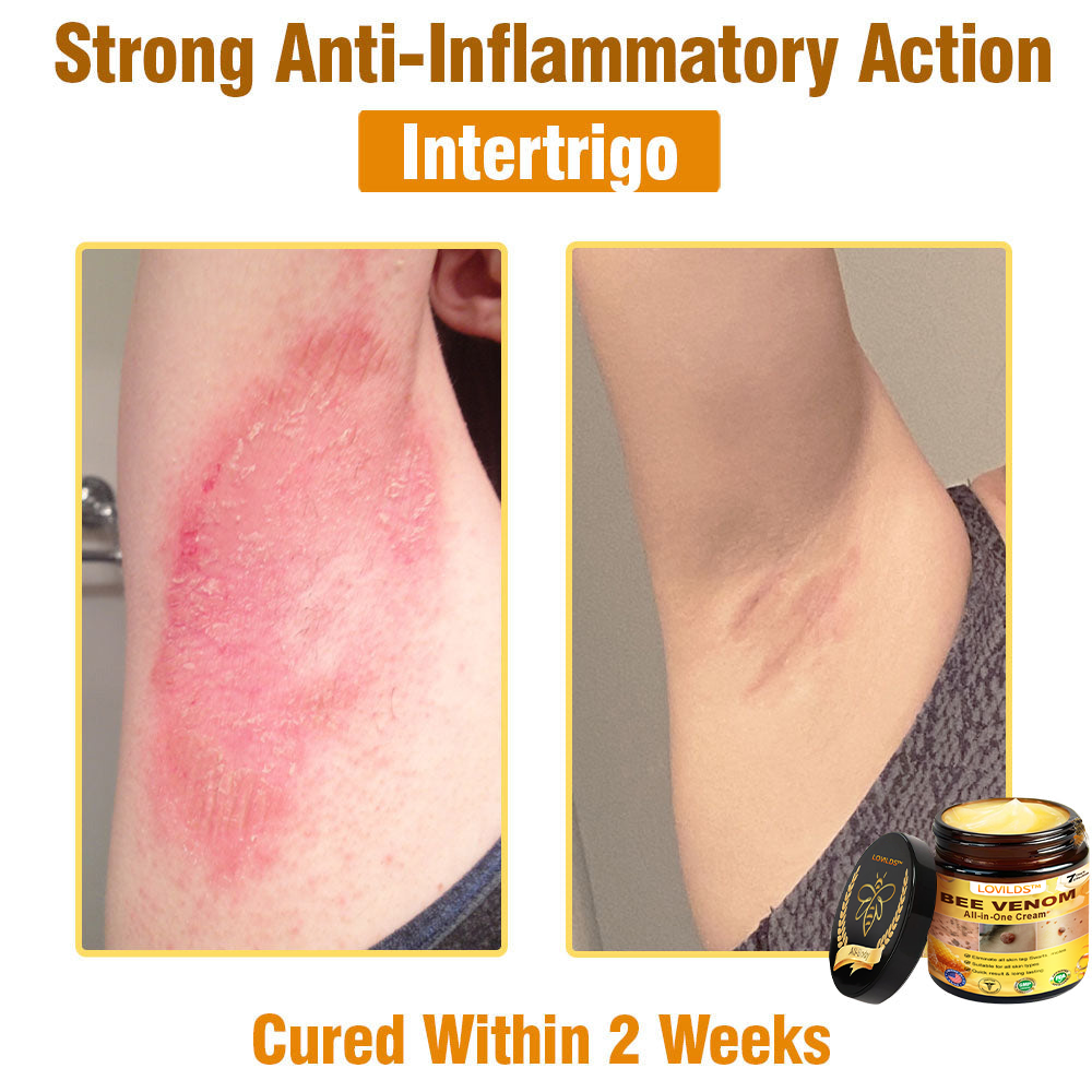 Bee Venom Cream – 🌸 Anti-Aging, Hydrating & Skin Repair