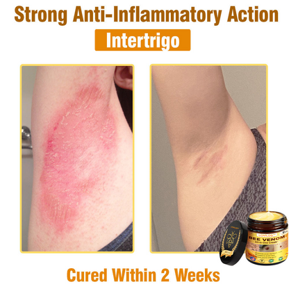 Bee Venom Cream – 🌸 Anti-Aging, Hydrating & Skin Repair