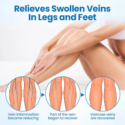 VeinGuard Herbal Spray✅ Clinically proven to eliminate varicose veins in just 7 days!