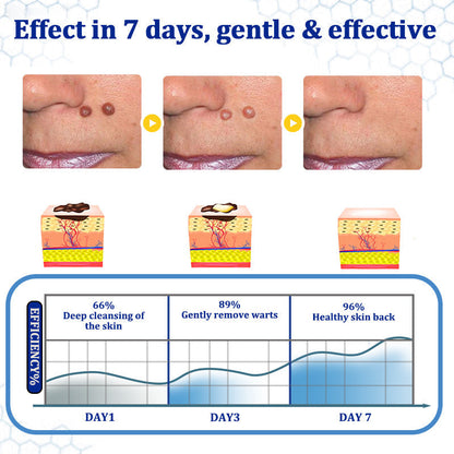 👩‍⚕️ BeeDerm RX Cream, Painless, easy and gentle fix for warts, skin tags, lumps, infections, cysts and scars🎁