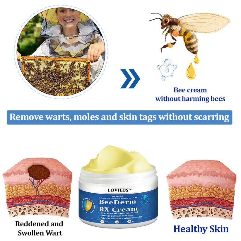 👩‍⚕️ BeeDerm RX Cream, Painless, easy and gentle fix for warts, skin tags, lumps, infections, cysts and scars🎁