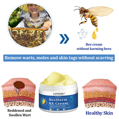👩‍⚕️ BeeDerm RX Cream, Painless, easy and gentle fix for warts, skin tags, lumps, infections, cysts and scars🎁