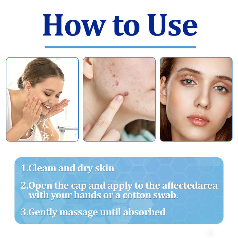 👩‍⚕️ BeeDerm RX Cream, Painless, easy and gentle fix for warts, skin tags, lumps, infections, cysts and scars🎁