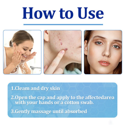 👩‍⚕️ BeeDerm RX Cream, Painless, easy and gentle fix for warts, skin tags, lumps, infections, cysts and scars🎁