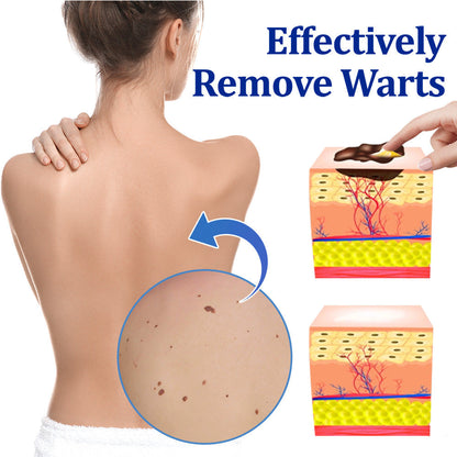 👩‍⚕️ BeeDerm RX Cream, Painless, easy and gentle fix for warts, skin tags, lumps, infections, cysts and scars🎁