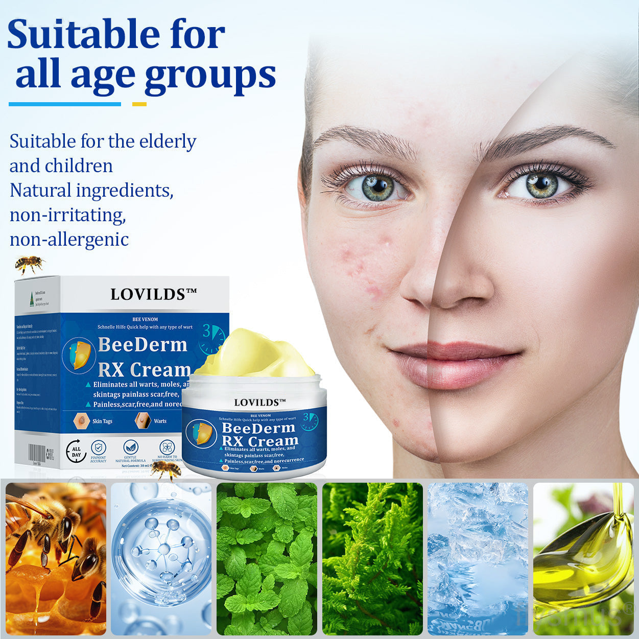 👩‍⚕️ BeeDerm RX Cream, Painless, easy and gentle fix for warts, skin tags, lumps, infections, cysts and scars🎁