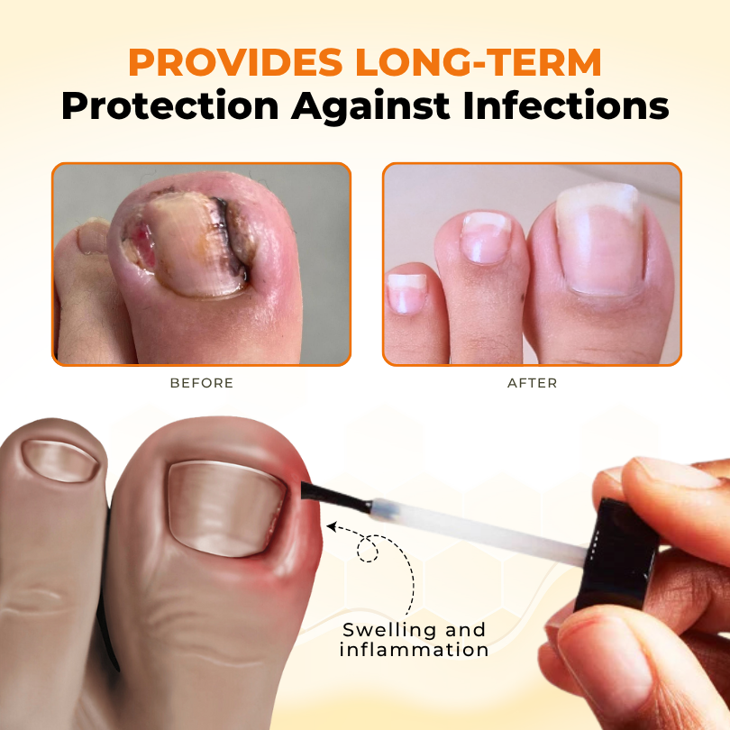 NailRevive Bee Venom Anti-fungi Solution