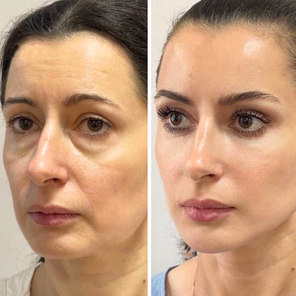 LiftRenew All-in-One Under-Eye Stick