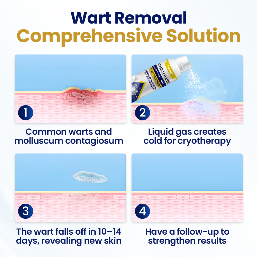 ChillErase Bump Renewal Spray