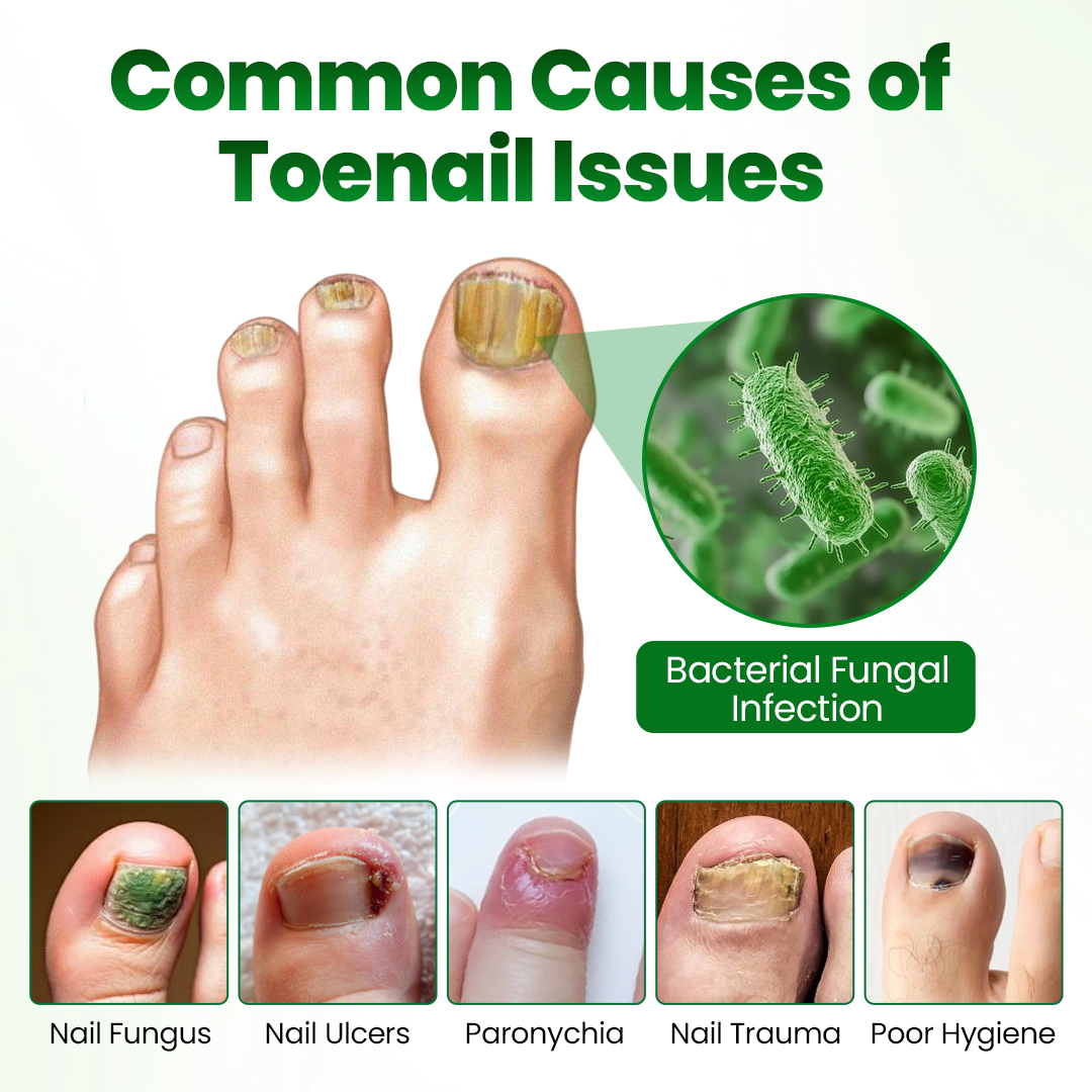 🔥Last day:70% off🔥 HerbaNail 7-Day Repair Serum 🔥 FDA Certified (Clinically Proven Herbal Formula for 7-Day Nail Fungus Repair & Strength Restoration 🌿)