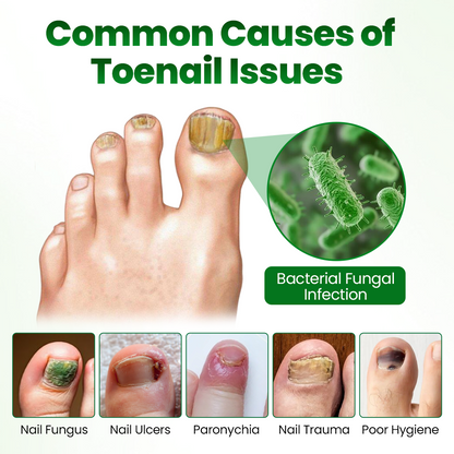 🔥Last day:70% off🔥 HerbaNail 7-Day Repair Serum 🔥 FDA Certified (Clinically Proven Herbal Formula for 7-Day Nail Fungus Repair & Strength Restoration 🌿)