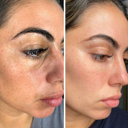 LiftRenew All-in-One Under-Eye Stick