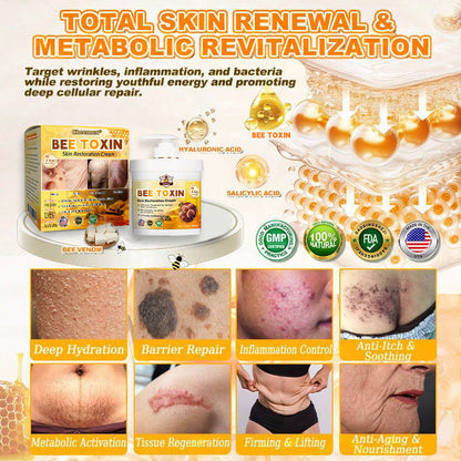 🐝🔥FDA Approved|BEE toxin Skin Restoration Cream (Anti-aging, Hydrating, Skin Repair, Even Tone, Acne and Dark Spot Treatment, Wart and Mole Removal, Psoriasis Relief)