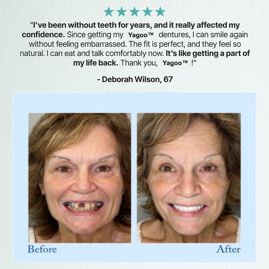 Hasecik®🦷Advanced Customized Full Denture Set🦷 (🔥10,000+ Sold In Last 30 Day)