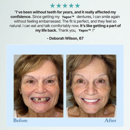 Hasecik®🦷Advanced Customized Full Denture Set🦷 (🔥10,000+ Sold In Last 30 Day)