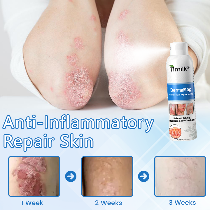 ✅ Official Store: DermaMag Magnesium Repair Spray 🔥 FDA Certified (Clinically Proven Relief for Psoriasis, Eczema, and Chronic Skin Irritation 🌿)