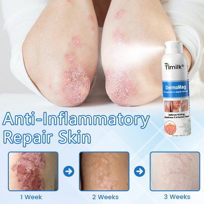 ✅ Official Store: DermaMag Magnesium Repair Spray 🔥 FDA Certified (Clinically Proven Relief for Psoriasis, Eczema, and Chronic Skin Irritation 🌿)