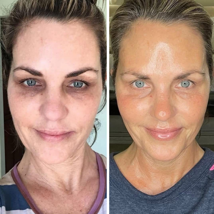 LiftRenew All-in-One Under-Eye Stick