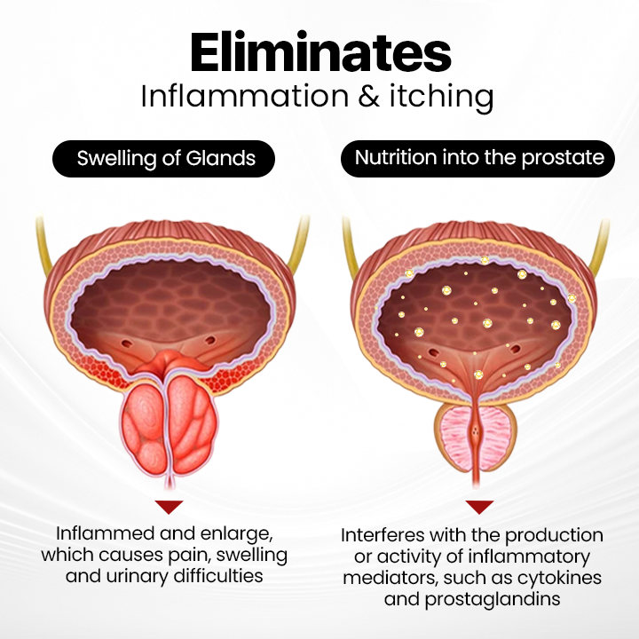 Last Day Discount: 87% OFF 🎇ProstaAir Dual-Function Nasal Inhaler🌟
