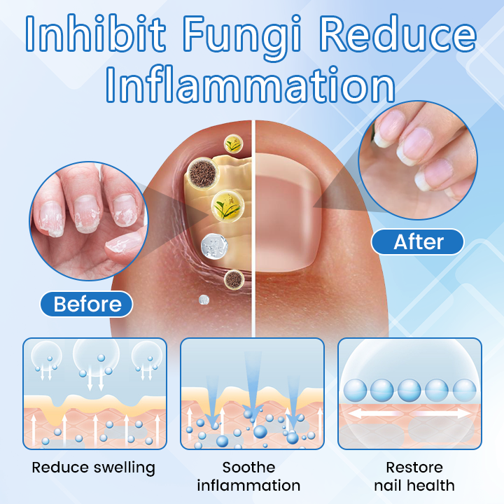 ✅ Official Store: DermaMag Magnesium Repair Spray 🔥 FDA Certified (Clinically Proven Relief for Psoriasis, Eczema, and Chronic Skin Irritation 🌿)