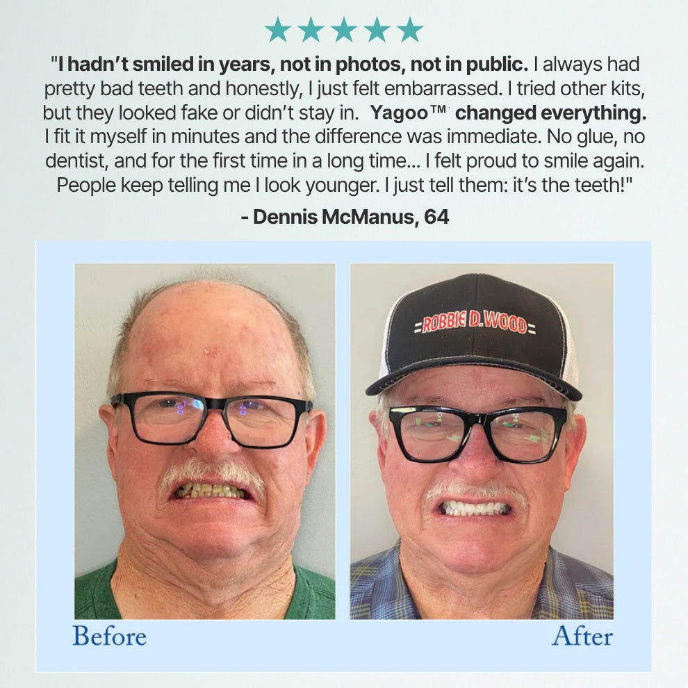 Hasecik®🦷Advanced Customized Full Denture Set🦷 (🔥10,000+ Sold In Last 30 Day)