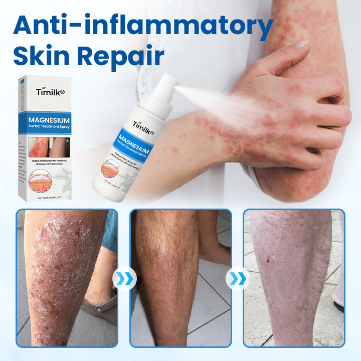 ✅Official Store | PCA Magnesium Deep Repair Spray