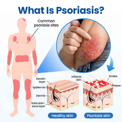 ✅Official Store | PCA Magnesium Deep Repair Spray