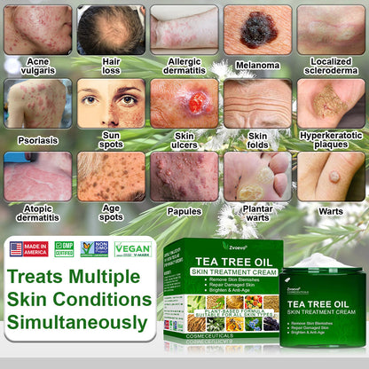 🔥𝐓𝐞𝐚 𝐓𝐫𝐞𝐞 𝐎𝐢𝐥 𝐒𝐤𝐢𝐧 𝐓𝐫𝐞𝐚𝐭𝐦𝐞𝐧𝐭 𝐂𝐫𝐞𝐚𝐦✅𝐅𝐃𝐀-𝐀𝐏𝐏𝐑𝐎𝐕𝐄𝐃 – Removes Skin Blemishes, Repairs Damaged Skin, Brightens & Anti-Ageing Care