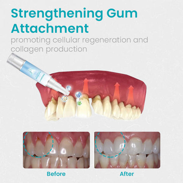 Gum Shield Therapy Gel