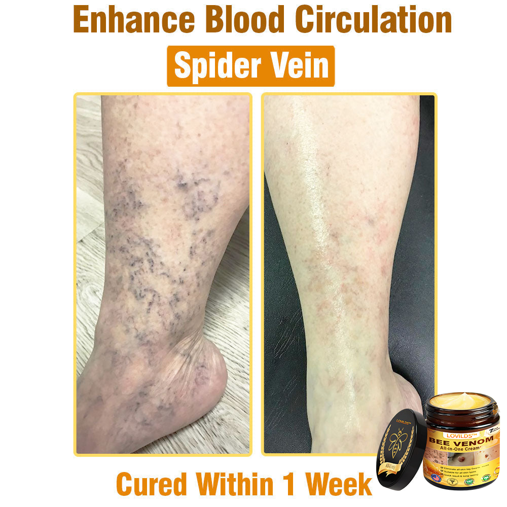 Bee Venom Cream – 🌸 Anti-Aging, Hydrating & Skin Repair