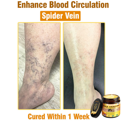 Bee Venom Cream – 🌸 Anti-Aging, Hydrating & Skin Repair