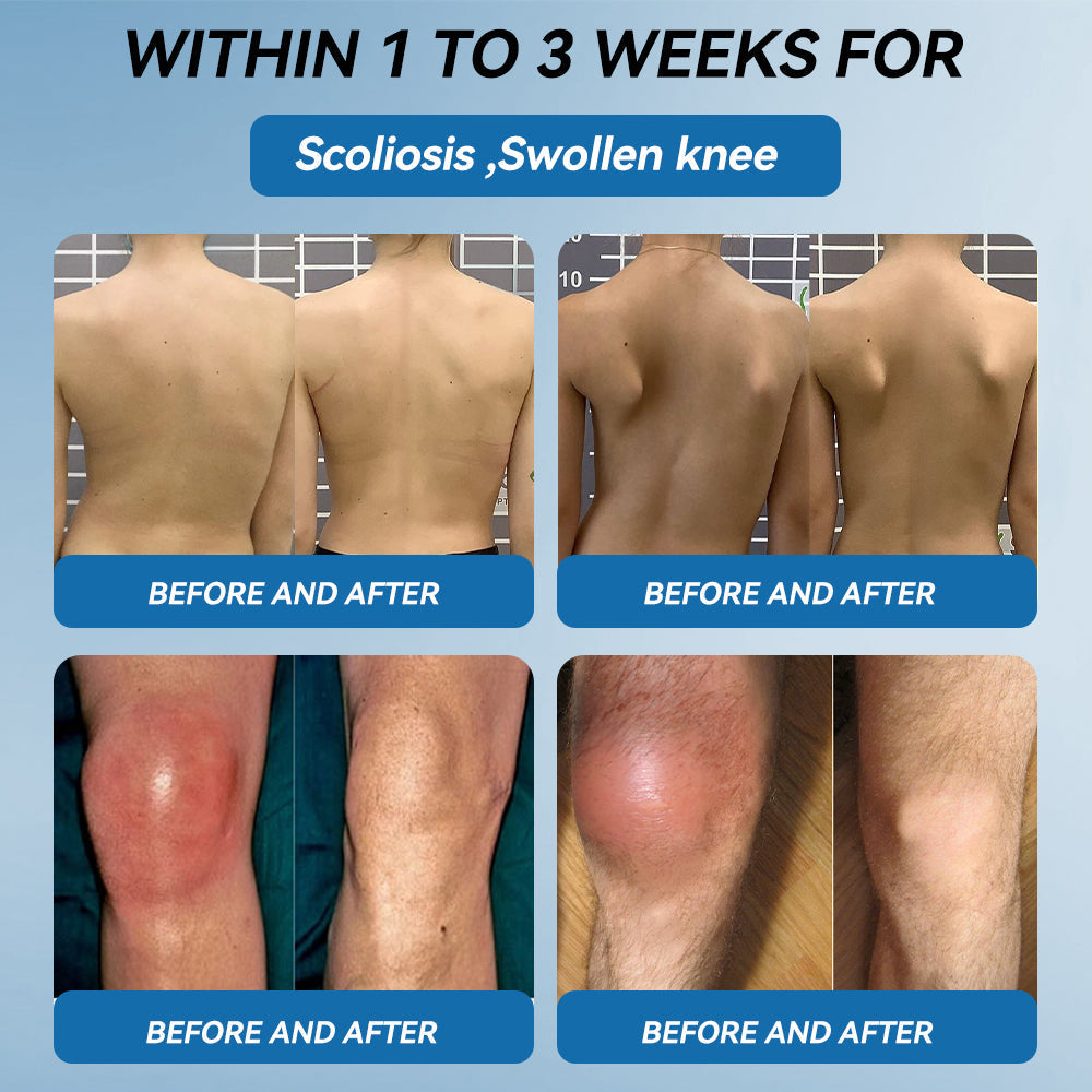 BPC-157 Joint Healing Cream🦴Treats Arthritis, Neuropathy, Rheumatism, Sports Injuries & More-USA👍