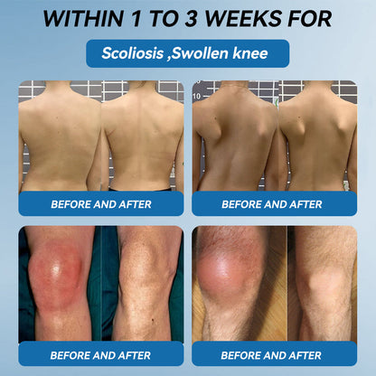 BPC-157 Joint Healing Cream🦴Treats Arthritis, Neuropathy, Rheumatism, Sports Injuries & More-USA👍