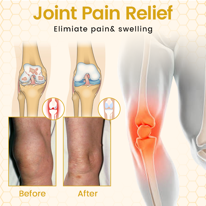 ⏰Last Day Promotion🔥Bee Venom Joint Cream