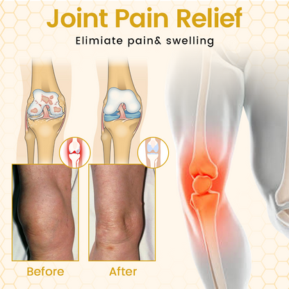 ⏰Last Day Promotion🔥Bee Venom Joint Cream