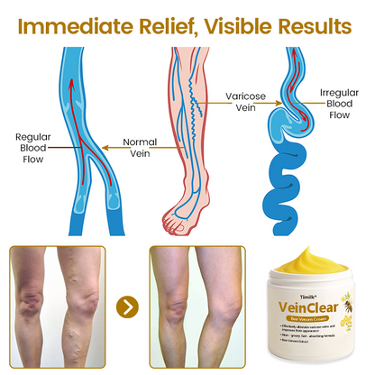 VeinClear Bee Venom Cream |✨ Visible Relief in Just 7 Days! 🦵🌿