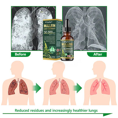 𝗢𝗳𝗳𝗶𝗰𝗶𝗮𝗹 𝗦𝘁𝗼𝗿𝗲:Organic lung-cleansing mullein leaf extract drops can relieve symptoms of cough, phlegm, asthma, and chronic obstructive pulmonary disease (COPD).