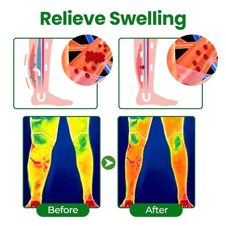 ✅Official Store | VenoLift Leg Relief Spray