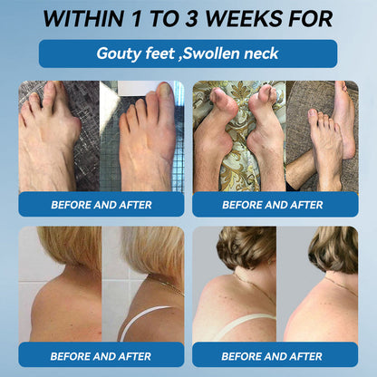 BPC-157 Joint Healing Cream🦴Treats Arthritis, Neuropathy, Rheumatism, Sports Injuries & More-USA👍