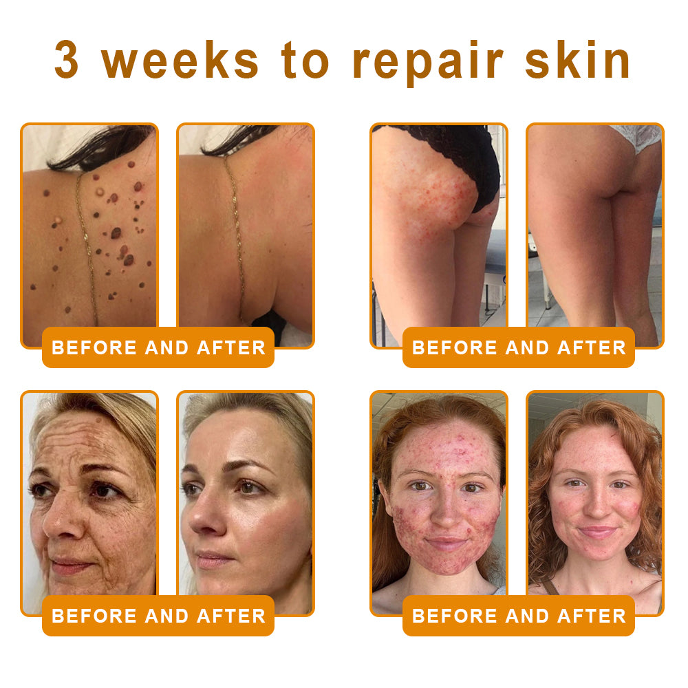 Made and Shipped from USA ✨ 𝐵𝑒𝑒 𝑉𝑒𝑛𝑜𝑚 & 𝑅𝑒𝑡𝑖𝑛𝑜𝑙 𝐶𝑜𝑚𝑝𝑙𝑒𝑥 𝑆𝑘𝑖𝑛 𝑅𝑒𝑠𝑡𝑜𝑟𝑎𝑡𝑖𝑜𝑛 𝐶𝑟𝑒𝑎𝑚🔥 LAST DAY 80% OFF 💎