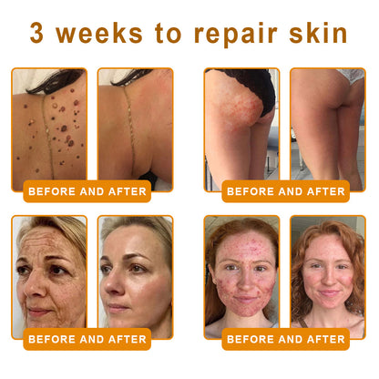 Made and Shipped from USA ✨ 𝐵𝑒𝑒 𝑉𝑒𝑛𝑜𝑚 & 𝑅𝑒𝑡𝑖𝑛𝑜𝑙 𝐶𝑜𝑚𝑝𝑙𝑒𝑥 𝑆𝑘𝑖𝑛 𝑅𝑒𝑠𝑡𝑜𝑟𝑎𝑡𝑖𝑜𝑛 𝐶𝑟𝑒𝑎𝑚🔥 LAST DAY 80% OFF 💎