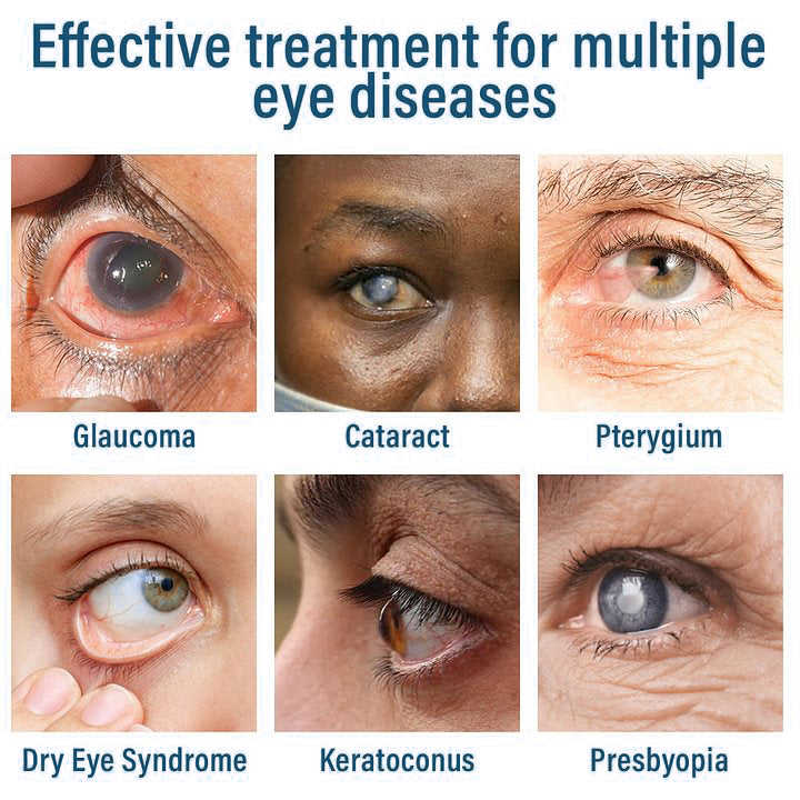 👩‍⚕️Nano Eye Drops Spray is developed by ophthalmologists and is backed by practical results.