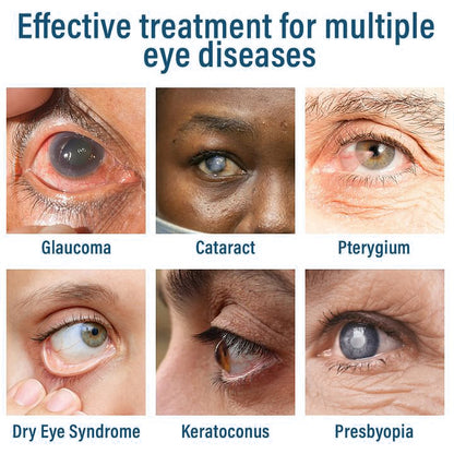 👩‍⚕️Nano Eye Drops Spray is developed by ophthalmologists and is backed by practical results.