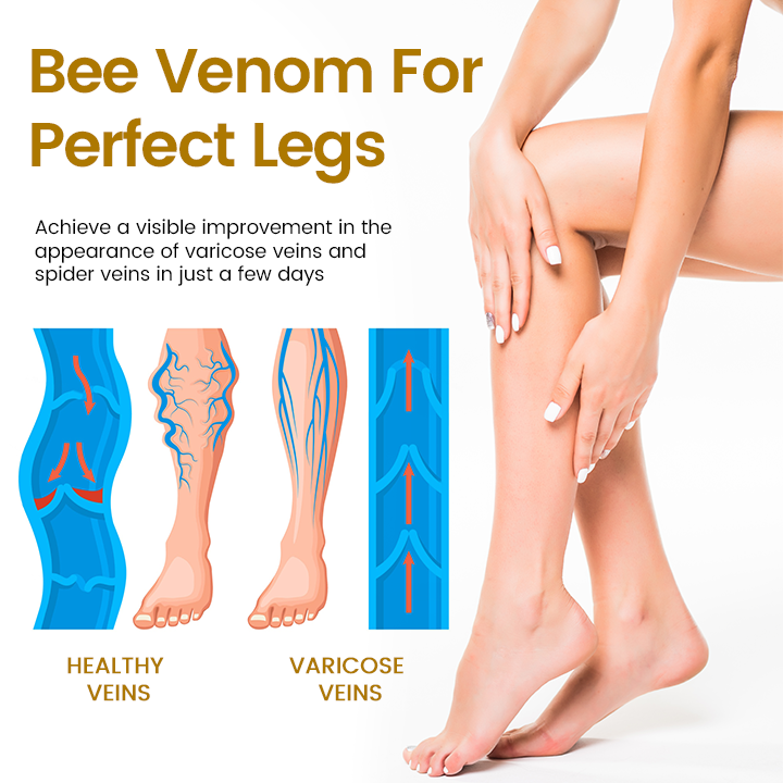 VeinClear Bee Venom Cream |✨ Visible Relief in Just 7 Days! 🦵🌿