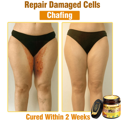 Bee Venom Cream – 🌸 Anti-Aging, Hydrating & Skin Repair